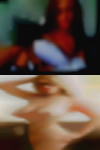 Women Burns